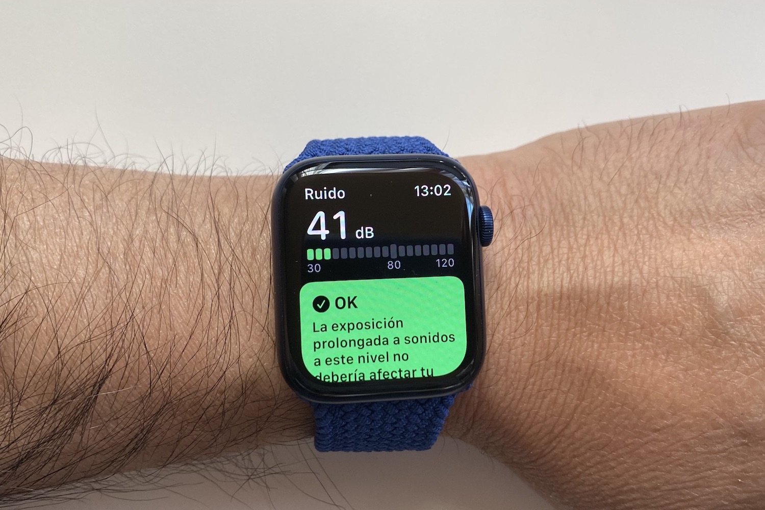 revision apple watch series 6 4