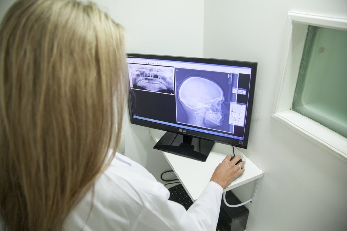 La imagen muestra a una doctora frente a una radiografía.