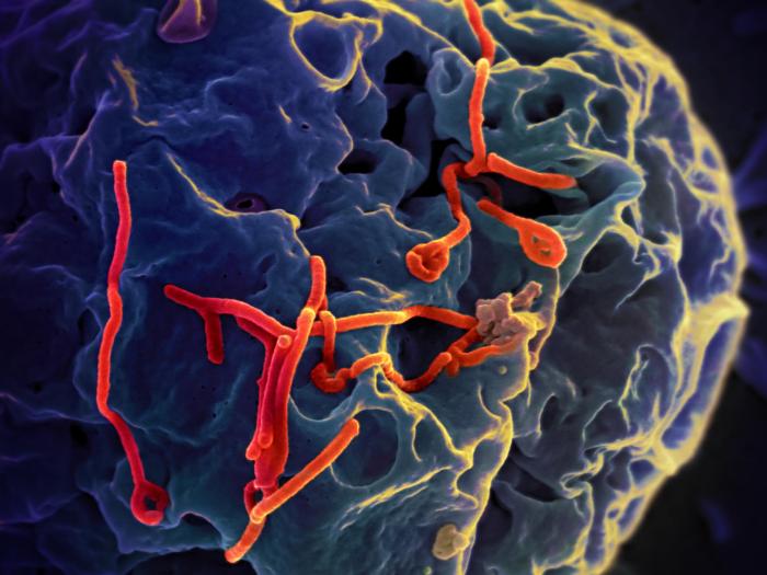 Una imagen del virus del ébola