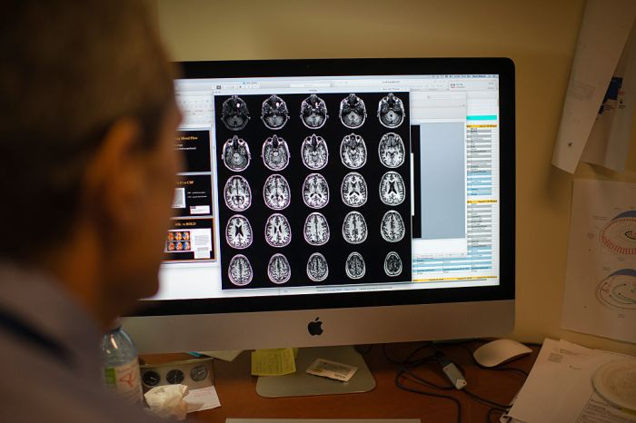 La imagen muestra a un neurólogo revisando escáneres cerebrales.