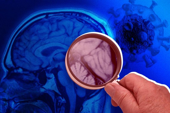 Una mano sosteniendo una lupa sobre la imagen de un cerebro, junto con una imagen del coronavirus.