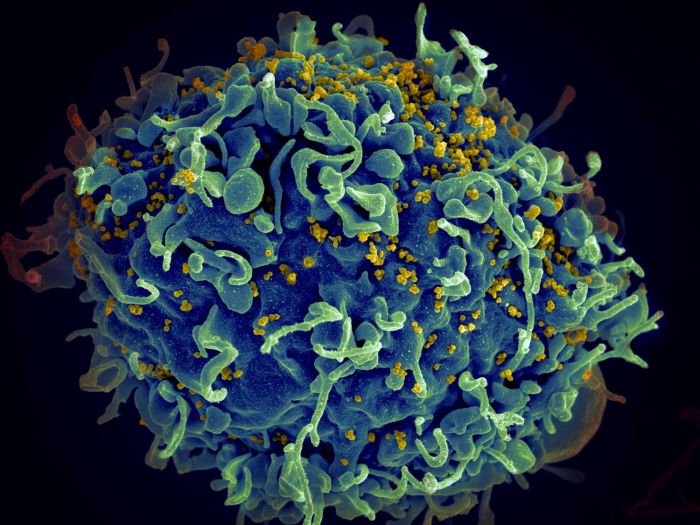 Virus del VIH atacando a una célula humana.