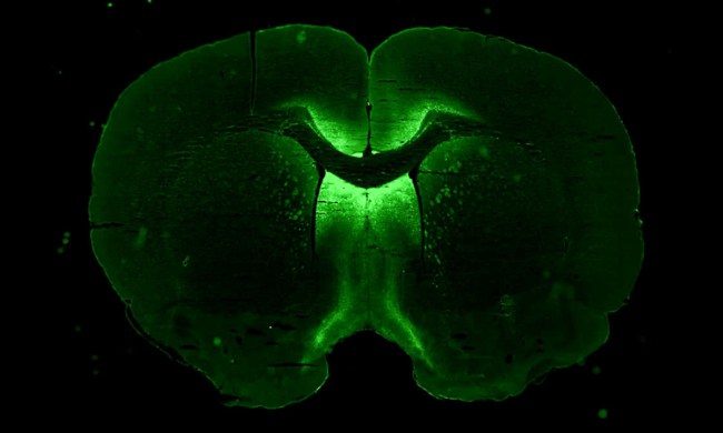 cerebro humano ensamblado 3d viajara estacion espacial internacional ng19 axonis brain