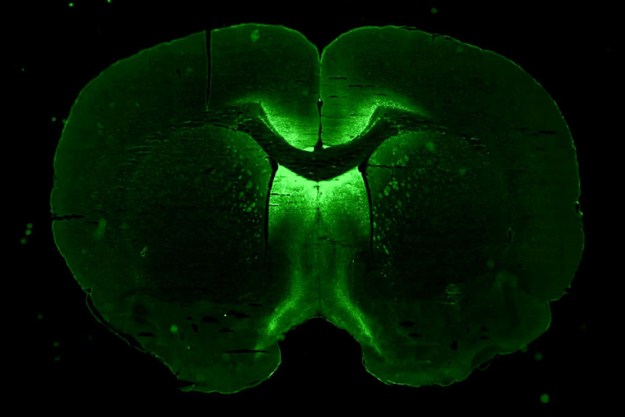 cerebro humano ensamblado 3d viajara estacion espacial internacional ng19 axonis brain